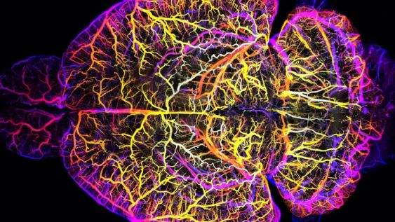 Coloured 3D reconstruction of a brain showing a dense, branching network of vessels or neurons against a dark background